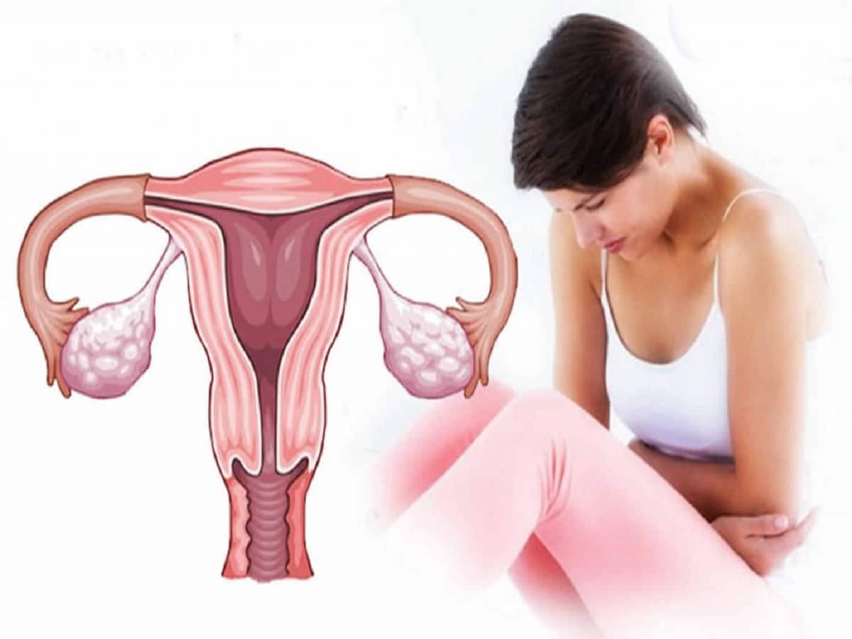How Cervical Cancer Impacts Woman’s Fertility? Doctors Explain